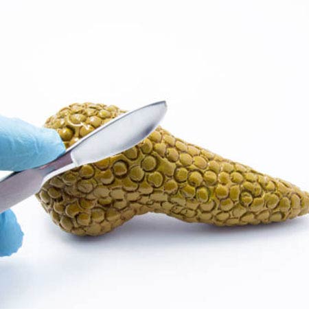 pancreatic surgery